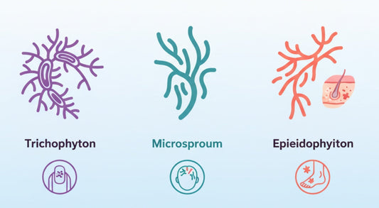 ¿Qué tipo de hongos elimina la terbinafina?